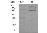 Recombinant Human HCLS1 Protein (His Tag) - ABMIUM