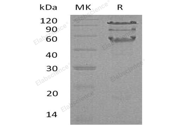 Recombinant Human HCLS1 Protein (His Tag) - ABMIUM