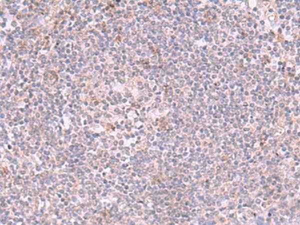 Anti-Human INPP5K Antibody