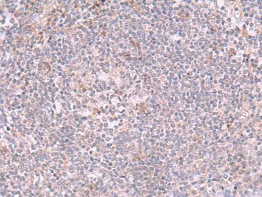 Anti-Human INPP5K Antibody