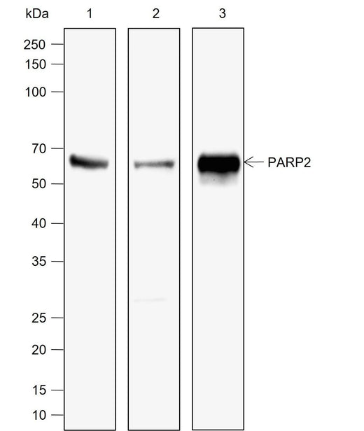 Anti-Human PARP2 Antibody [A783] - ABMIUM