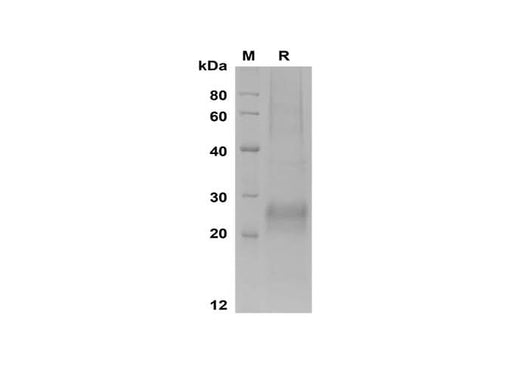 SDS-PAGE analysis of Human ESM‑1 proteins, 2 μg/lane of Recombinant Human ESM‑1 proteins was resolved with SDS-PAGE under reducing conditions, showing bands at 23-27 kDa.