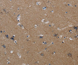 Anti-Human/Mouse PIK3CG Antibody - ABMIUM