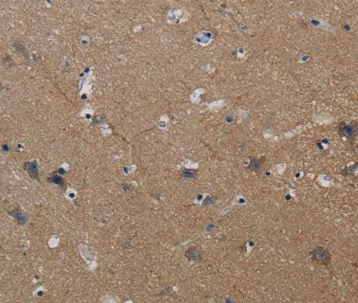 Anti-Human/Mouse PIK3CG Antibody