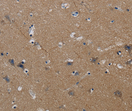 Anti-Human/Mouse PIK3CG Antibody - ABMIUM