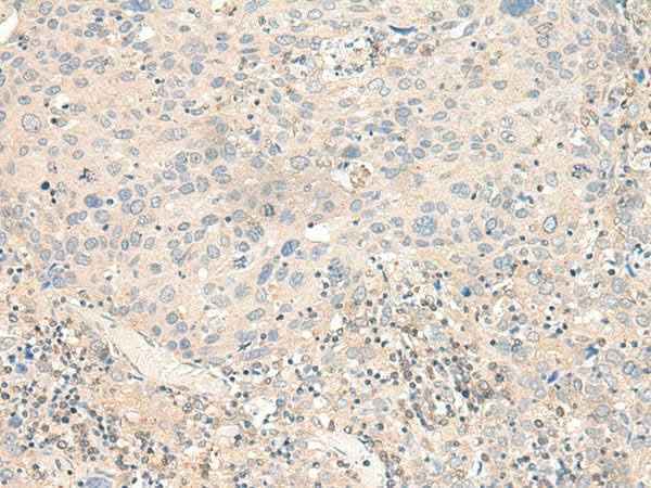 Anti-Human/Mouse KCNA10 Antibody