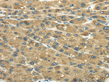 Anti-Human UGT2B4 Antibody - ABMIUM