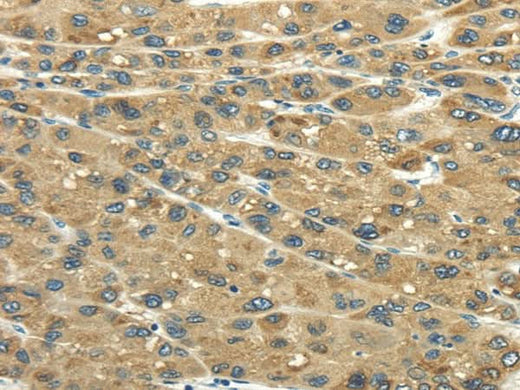 Anti-Human UGT2B4 Antibody - ABMIUM