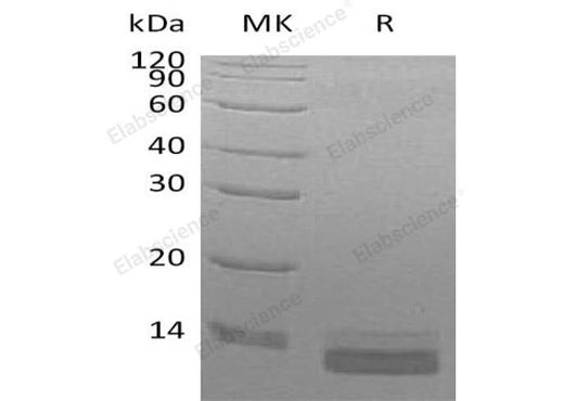 Recombinant Human CCL14/HCC-3 Protein (His Tag) - ABMIUM