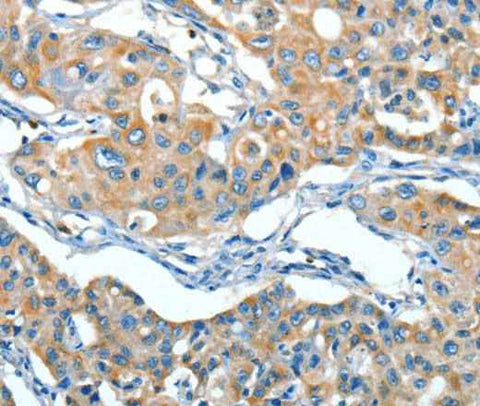 Anti-Human SERPINA3 Antibody