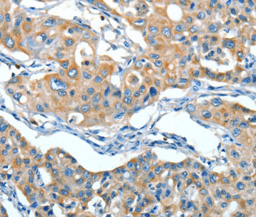 Anti-Human SERPINA3 Antibody - ABMIUM