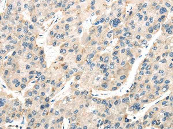 Anti-Human/Mouse/Rat TXNIP Antibody