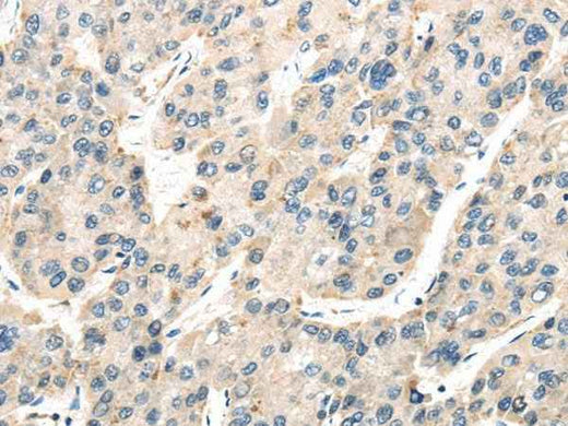 Anti-Human/Mouse/Rat TXNIP Antibody