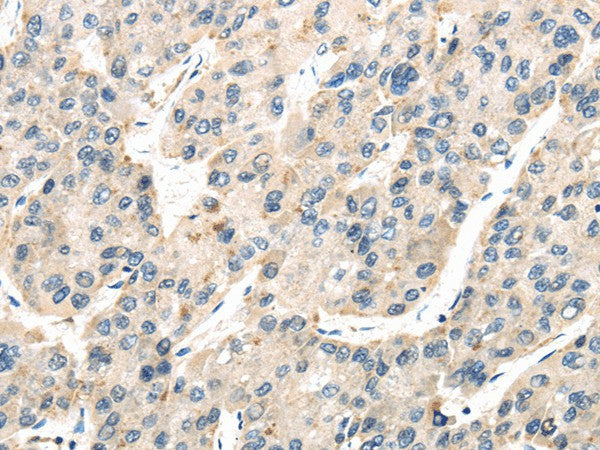 Anti-Human/Mouse/Rat TXNIP Antibody - ABMIUM