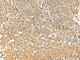 Immunohistochemistry of paraffin-embedded Human tonsil tissue using PWP1 Polyclonal Antibody at dilution of 1:50(×200)