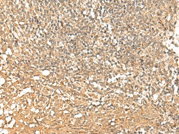 Immunohistochemistry of paraffin-embedded Human tonsil tissue using PWP1 Polyclonal Antibody at dilution of 1:50(×200)