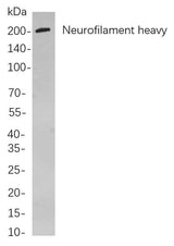 Anti-Human/Mouse/Rat Neurofilament heavy polypeptide Antibody [B782]
