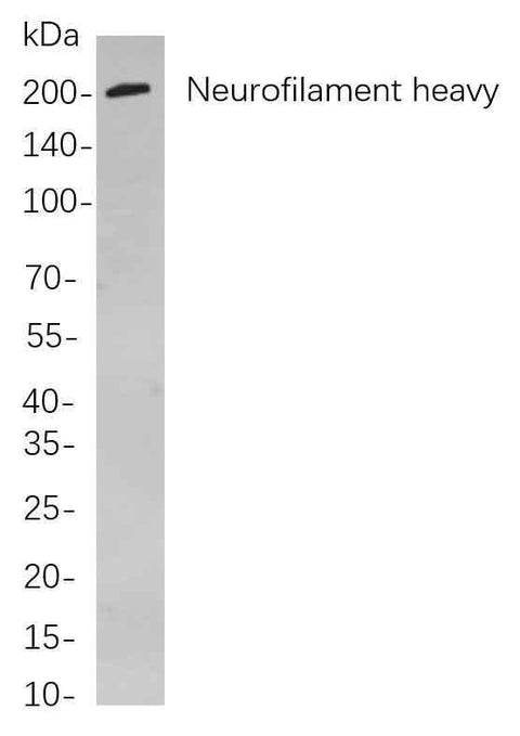 Anti-Human/Mouse/Rat Neurofilament heavy polypeptide Antibody [B782] - ABMIUM