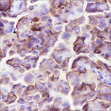 Anti-Human NaPi2b Antibody [A311]