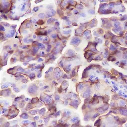 Anti-Human NaPi2b Antibody [A311] - ABMIUM