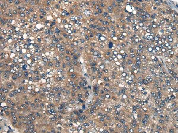 Anti-Human/Mouse/Rat ICMT Antibody