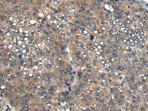 Anti-Human/Mouse/Rat ICMT Antibody