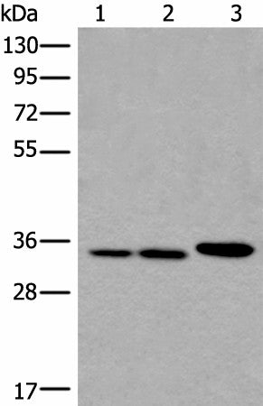 Western blot analysis of A549 Hela and K562 cell lysates using RPF2 Polyclonal Antibody at dilution of 1:400