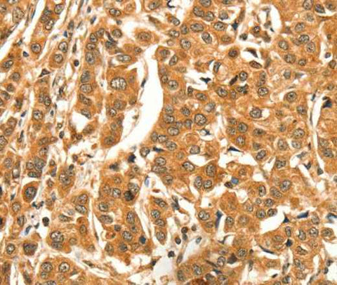 Anti-Human DIRAS1 Antibody