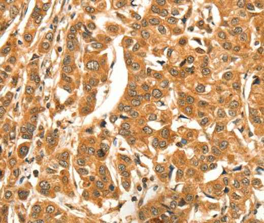 Anti-Human DIRAS1 Antibody
