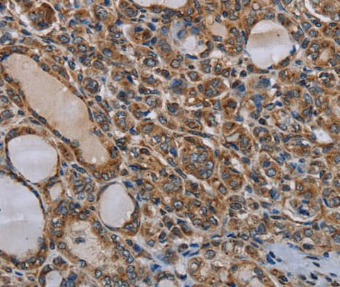 Anti-Human MT-ND6 Antibody - ABMIUM