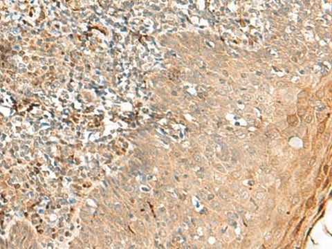 Immunohistochemistry of paraffin-embedded Human tonsil tissue using ZNF397 Polyclonal Antibody at dilution of 1:45(×200)