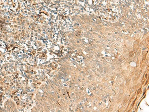Immunohistochemistry of paraffin-embedded Human tonsil tissue using ZNF397 Polyclonal Antibody at dilution of 1:45(×200)