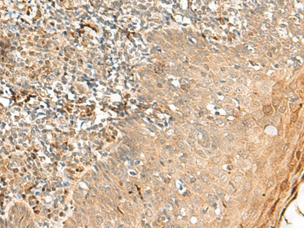 Immunohistochemistry of paraffin-embedded Human tonsil tissue using ZNF397 Polyclonal Antibody at dilution of 1:45(×200)