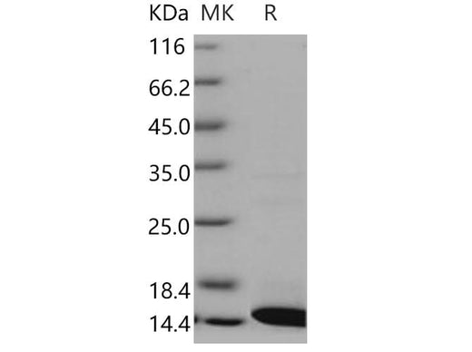 Recombinant Human COX5B Protein (His Tag) - ABMIUM