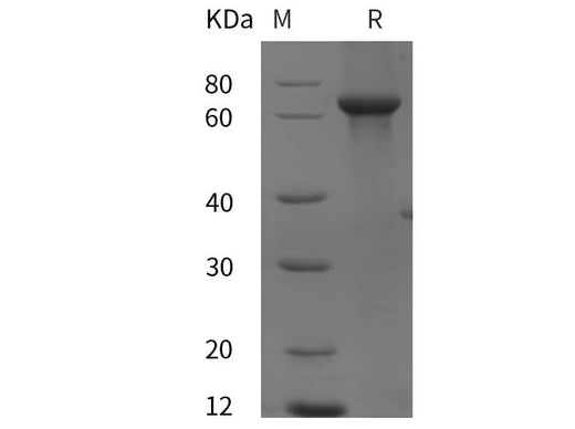 SDS-PAGE analysis of Human SDHA proteins, 2 μg/lane of Recombinant Human SDHA proteins was resolved with SDS-PAGE under reducing conditions, showing bands at 70 kDa.