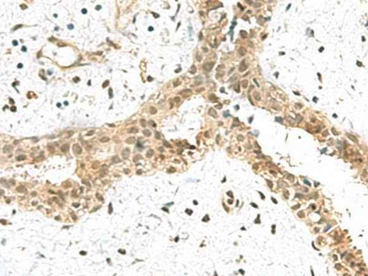 Anti-Human/Mouse/Rat ELOC Antibody