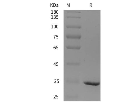 SDS-PAGE analysis of Rat CD109 proteins, 2 μg/lane of Recombinant Rat CD109 proteins was resolved with SDS-PAGE under reducing conditions, showing bands at 35 kDa.