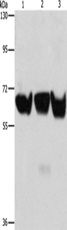 Anti-Human/Mouse/Rat ADRA1B Antibody - ABMIUM