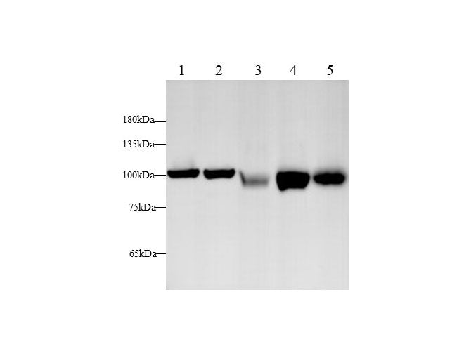 Anti-Human/Mouse/Rat EEF2 Antibody - ABMIUM