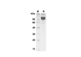 SDS-PAGE analysis of Human BCAM proteins , 2 μg/lane of Recombinant Human BCAM proteins was resolved with SDS-PAGE under reducing conditions , showing bands at 90 kDa.