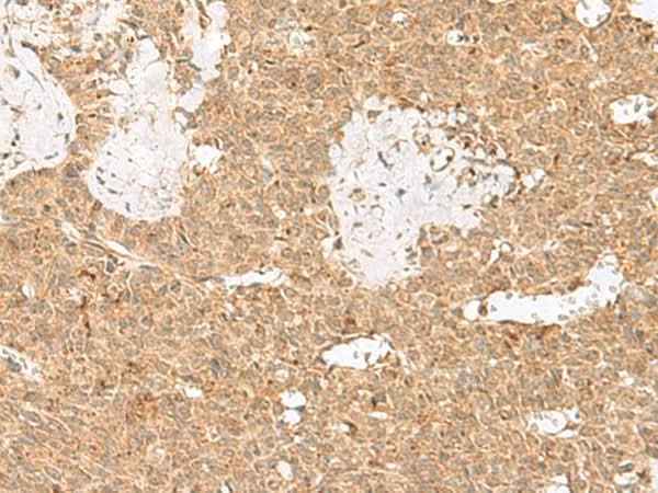 Anti-Human/Mouse LGALSL Antibody