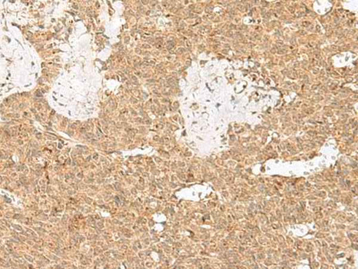 Anti-Human/Mouse LGALSL Antibody