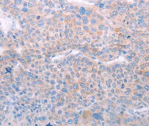 Anti-Human/Mouse/Rat SPATA6 Antibody
