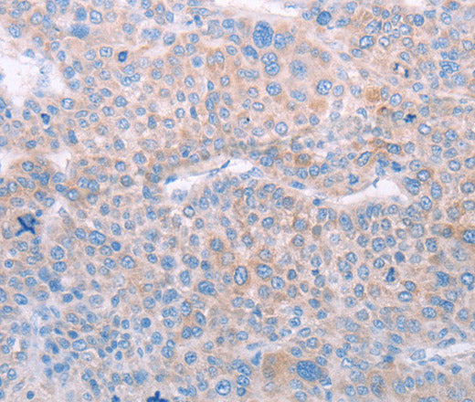 Anti-Human/Mouse/Rat SPATA6 Antibody - ABMIUM