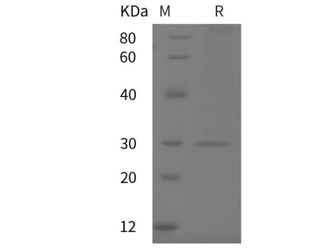 SDS-PAGE analysis of Mouse CRP/C-Reactive proteins, 2 μg/lane of Recombinant Mouse CRP/C-Reactive proteins was resolved with SDS-PAGE under reducing conditions, showing bands at 30 kDa.