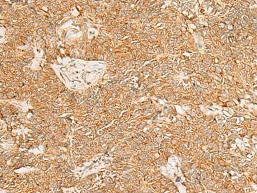 Anti-Human/Mouse/Rat PDCD4 Antibody