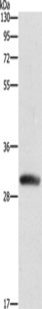 Anti-Human/Mouse/Rat DCK Antibody - ABMIUM