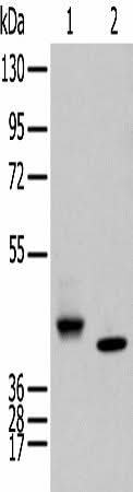 Western blot analysis of Human fetal brain tissue and Human kidney tissue using IDO2 Polyclonal Antibody at dilution of 1:450