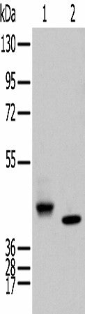 Western blot analysis of Human fetal brain tissue and Human kidney tissue using IDO2 Polyclonal Antibody at dilution of 1:450