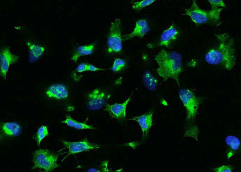 Anti-Human RHOA Antibody [B347] - ABMIUM